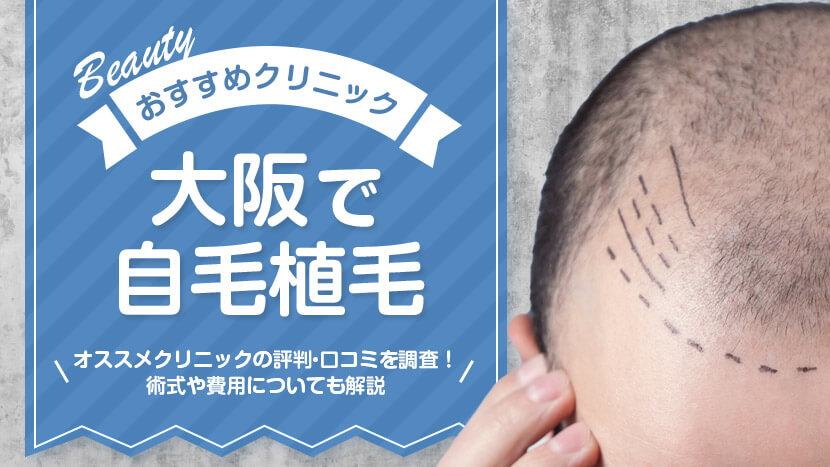 大阪で自毛植毛をするなら？オススメクリニックの評判・口コミを調査！術式や費用についても解説