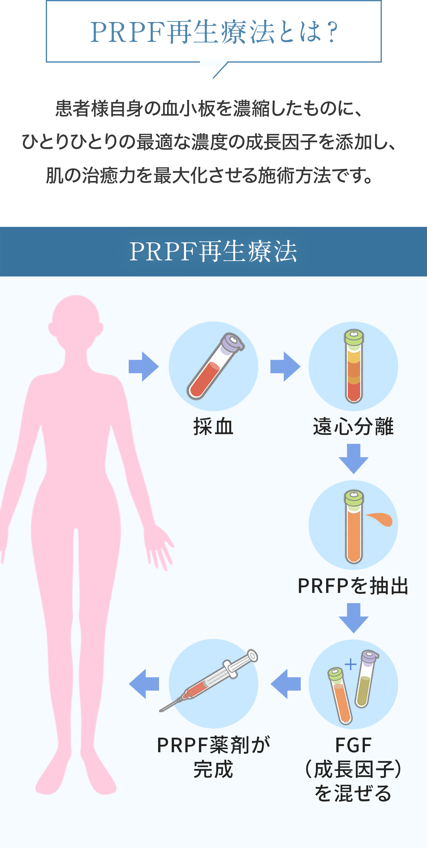 PRPF再生療法とは？